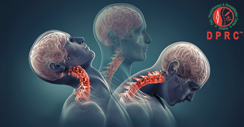 ঘাড় ব্যথায় চিকিৎসা-পরামর্শ দিয়েছেন রিহাব-ফিজিও বিশেষজ্ঞ ডা. মোঃ সফিউল্যাহ্ প্রধান