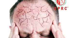 ডিমেনশিয়া