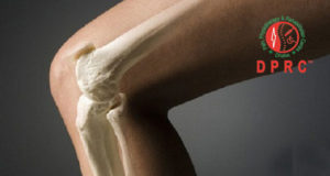 অস্টিওপোরোসিস