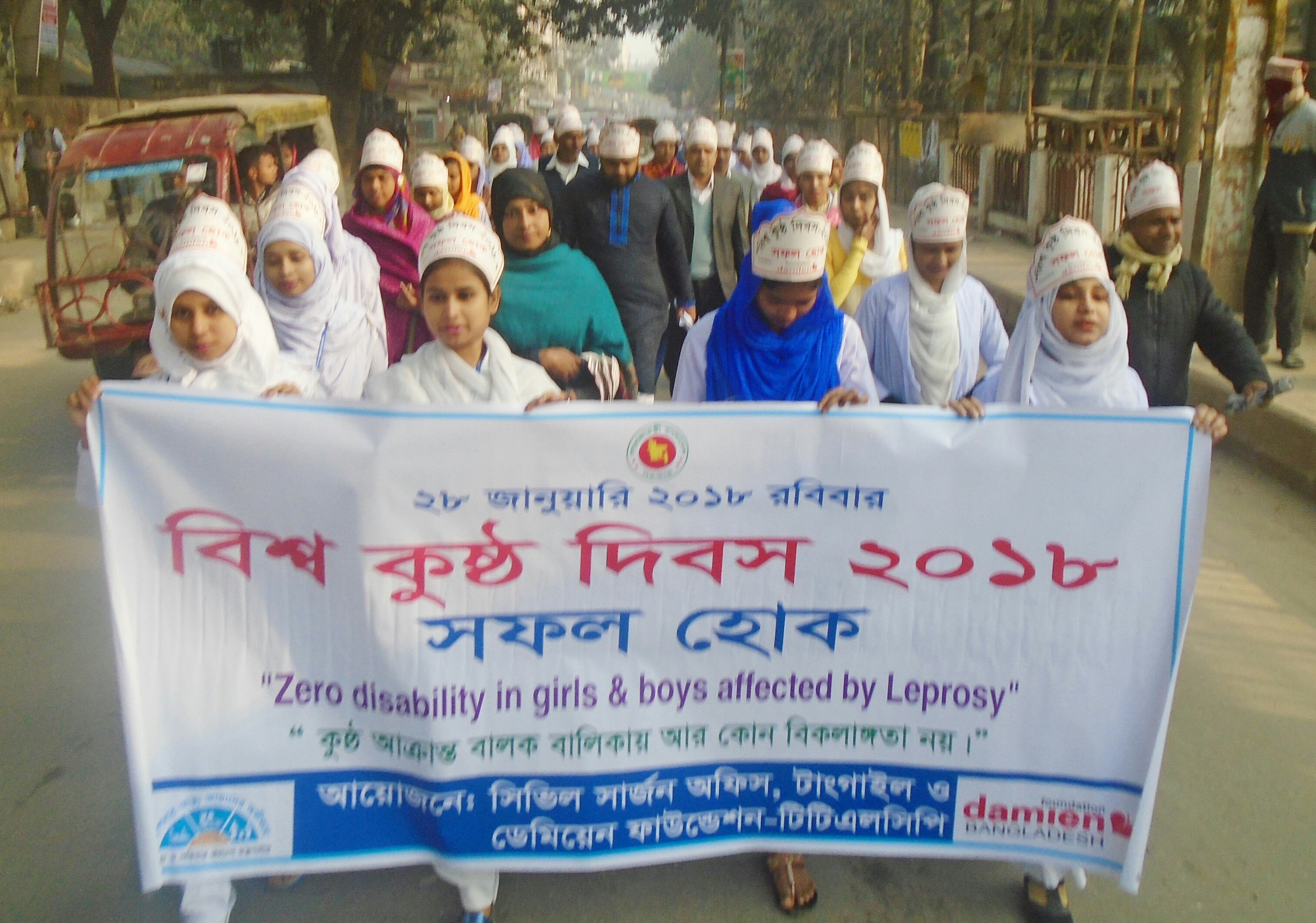 কুষ্ঠ আক্রান্ত বালক বালিকা