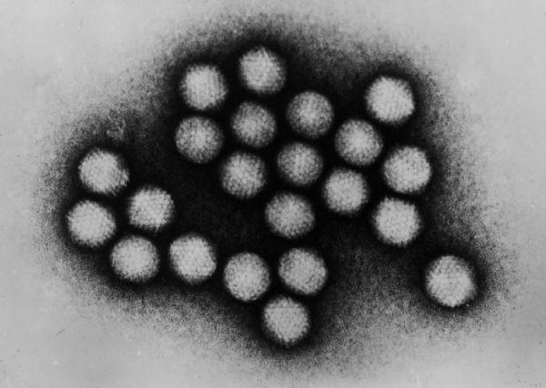 Adenovirus Infection (Killer Cold Virus (Adenovirus Infection, Ad14))