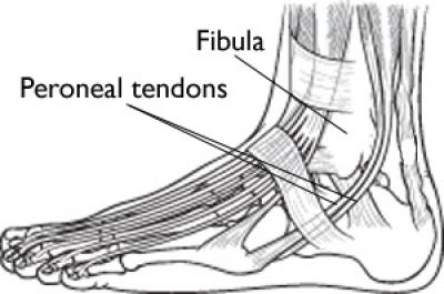 Ankle Pain and Tendinitis